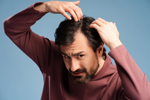 Ayurvedic Treatment for Dandruff